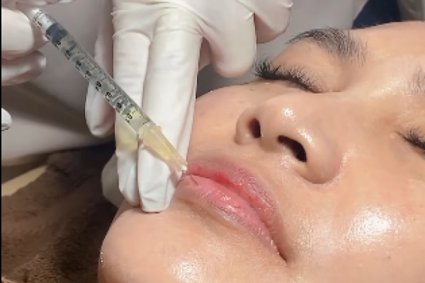 From Lip Booster to Lip Filler!