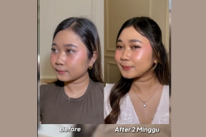 Wajah tirus dalam 2 minggu?