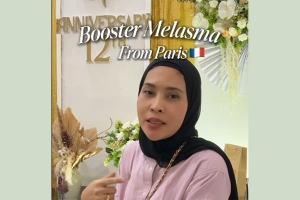 1x treatment, melasma langsung tampak lebih cerah!